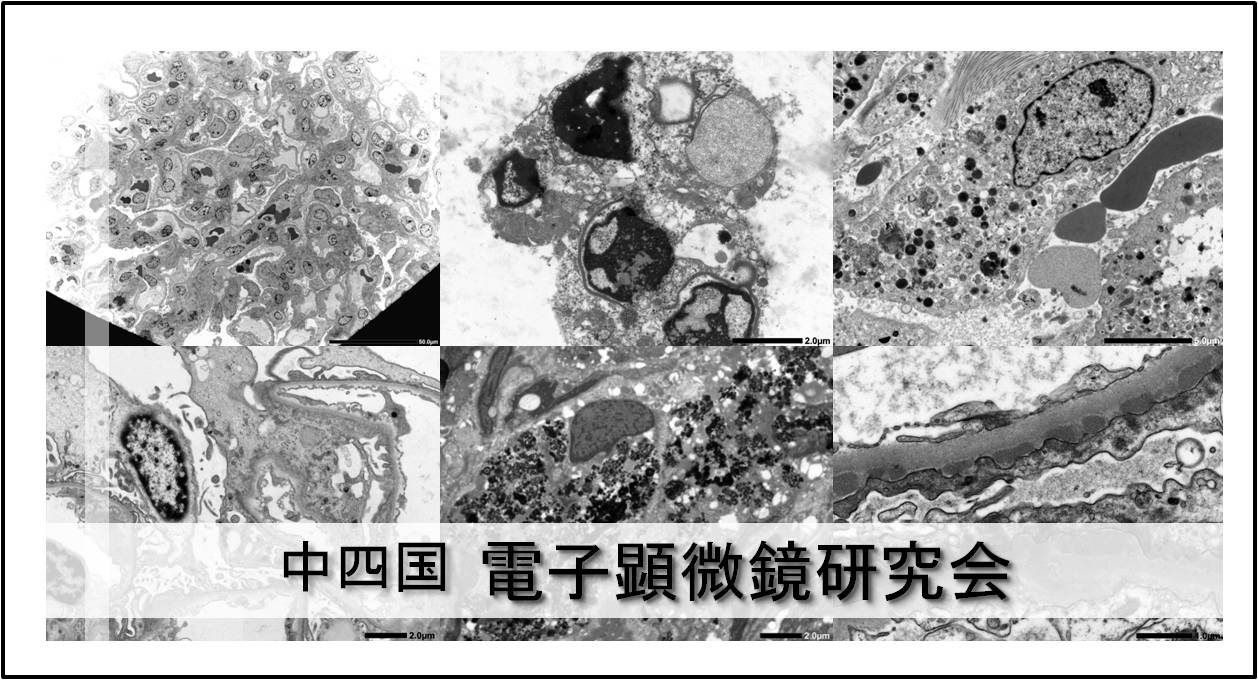 電子顕微鏡研究イメージ