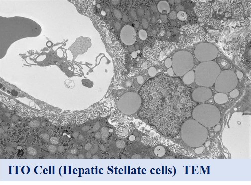 TEM (hepatic stellate cell)