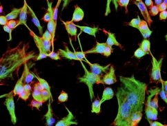 Immunocytochemistry (actin)