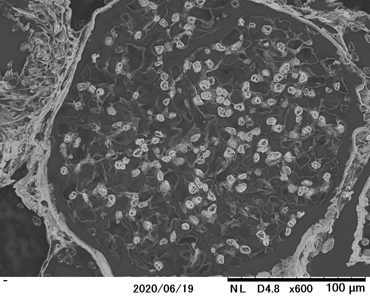 LV-SEM (renal glomerulus)